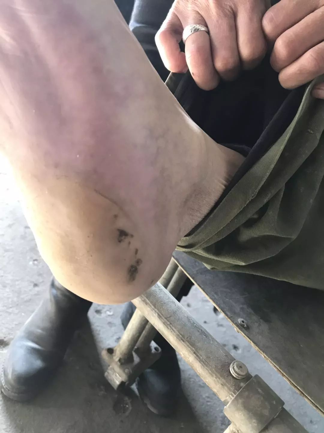 高压线下莫建房!河北一男子建房触电身亡(现场照片可能引起不适,慎入)