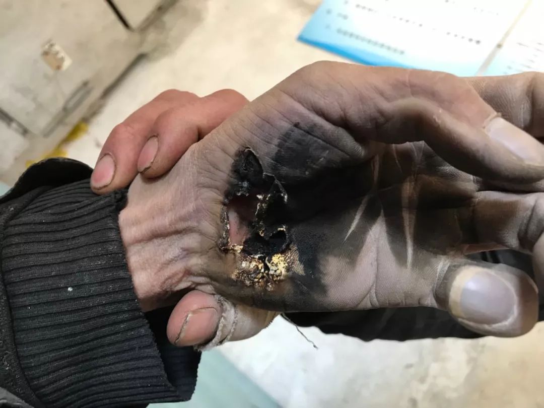 高压线下莫建房!河北一男子建房触电身亡(现场照片可能引起不适,慎入)