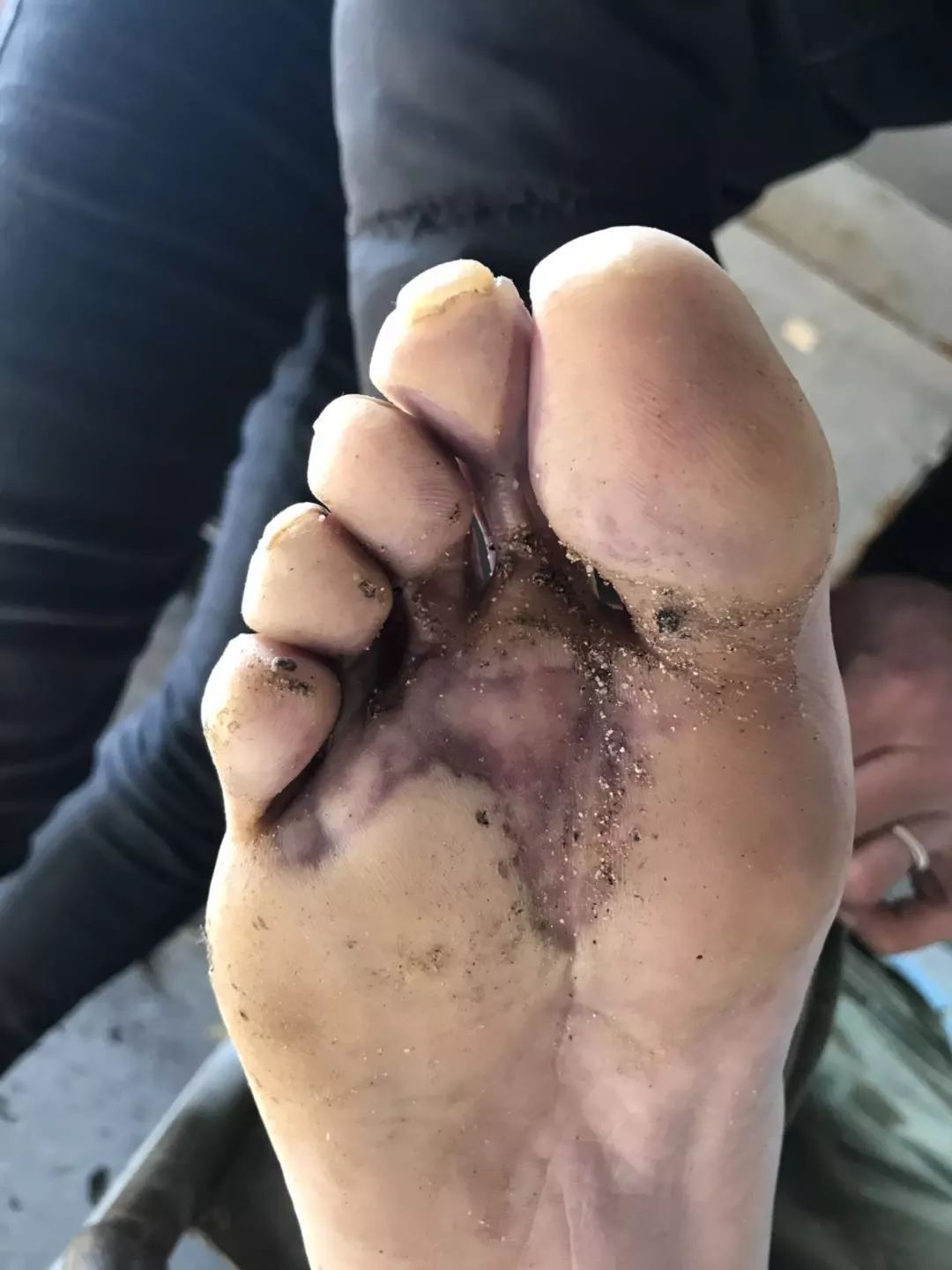 高压线下莫建房河北一男子建房触电身亡现场照片可能引起不适慎入