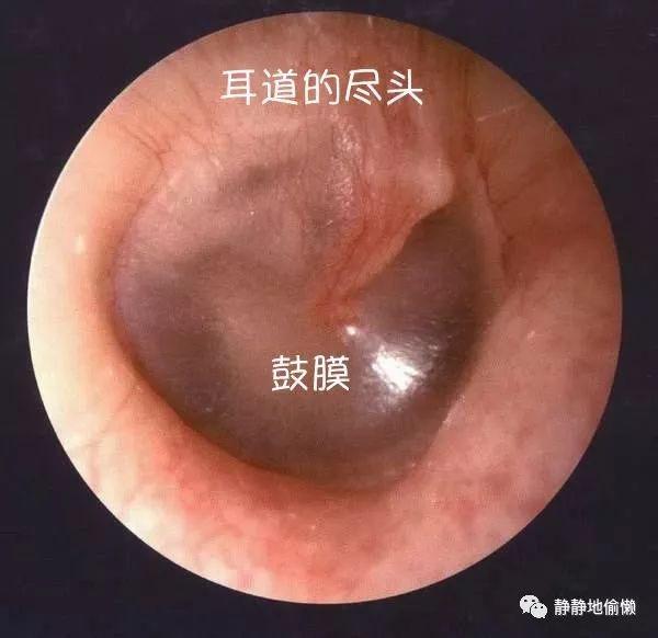 为什么蟑螂喜欢半夜进耳朵猫咪会不会卡鱼刺今天有了答案