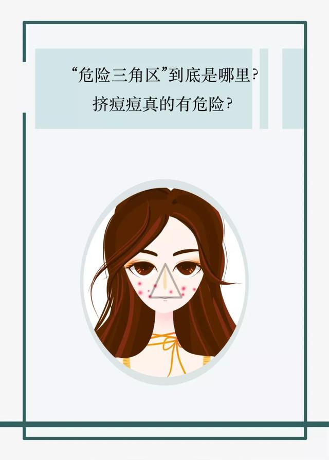三角区痘痘不能挤那该拿它们怎么办呢