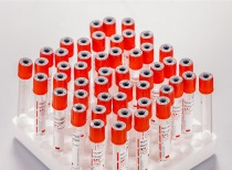 致死率高达10%！蔓延11国 猴痘病毒已在社区隐匿传播 美国采购数百万疫苗